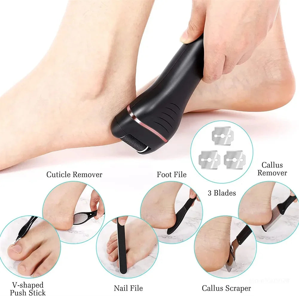 Rechargeable Electric Heel & Callus Remover